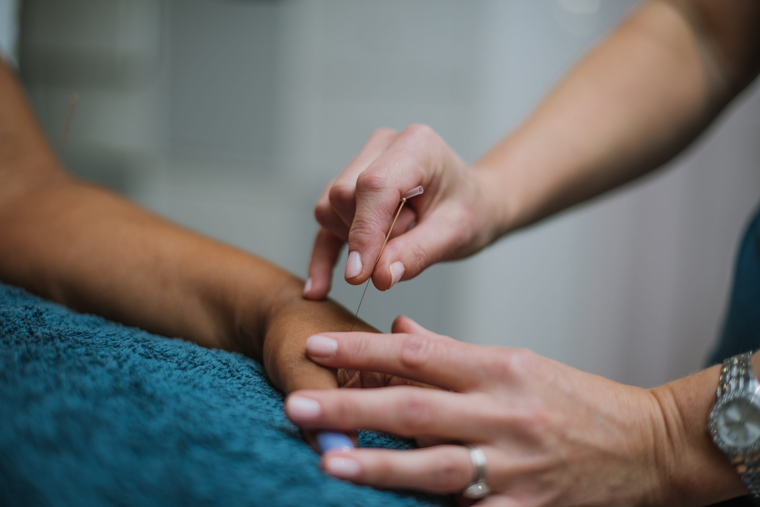 Acupuncture Halifax