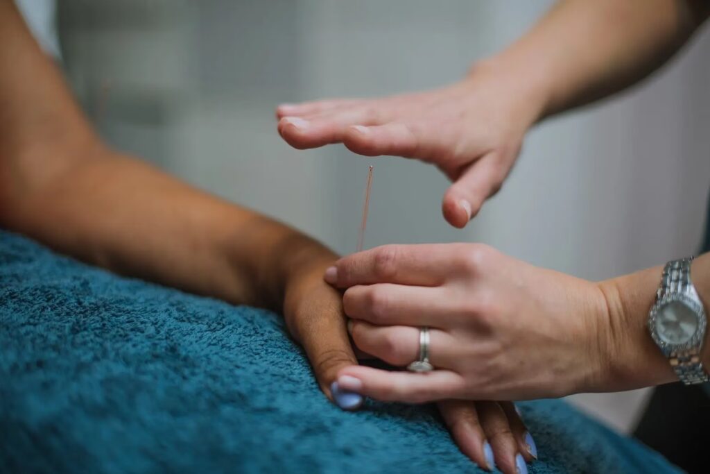 Accupuncture converted 1